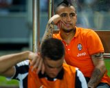 Allegri: Vidal Selalu Hebat & Penting